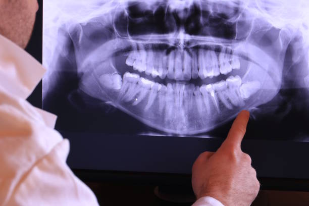 Best Emergency Dental Care for Broken or Chipped Teeth in Claymont, DE