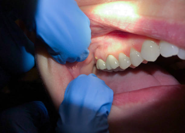 Best Urgent Care for Lost Fillings or Crowns in Claymont, DE